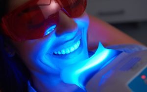 instant teeth whitening-cover